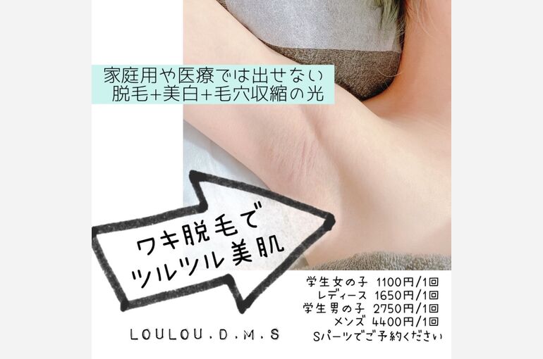 S__69435395