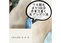 S__69550107