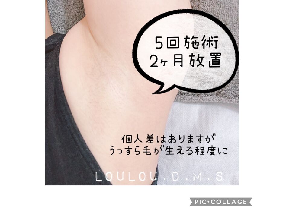 S__69550106