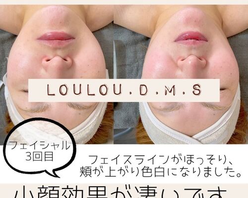 S__105701398